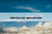 曼联伤兵怎么过度（曼联伤停补时反超）