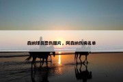 森纳球员悲伤图片，阿森纳伤病名单